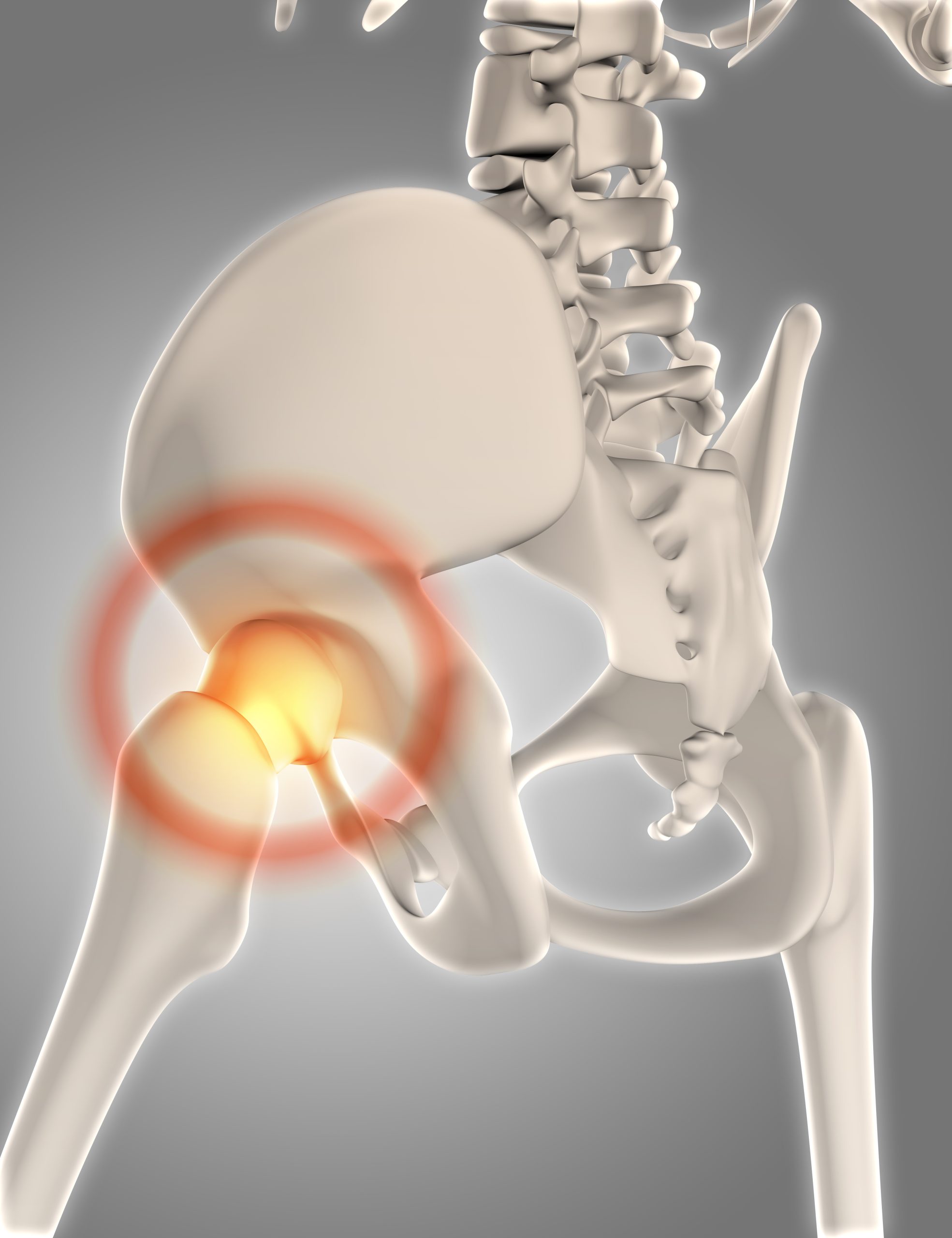 3D render of a skeleton with hip highlighted showing pain