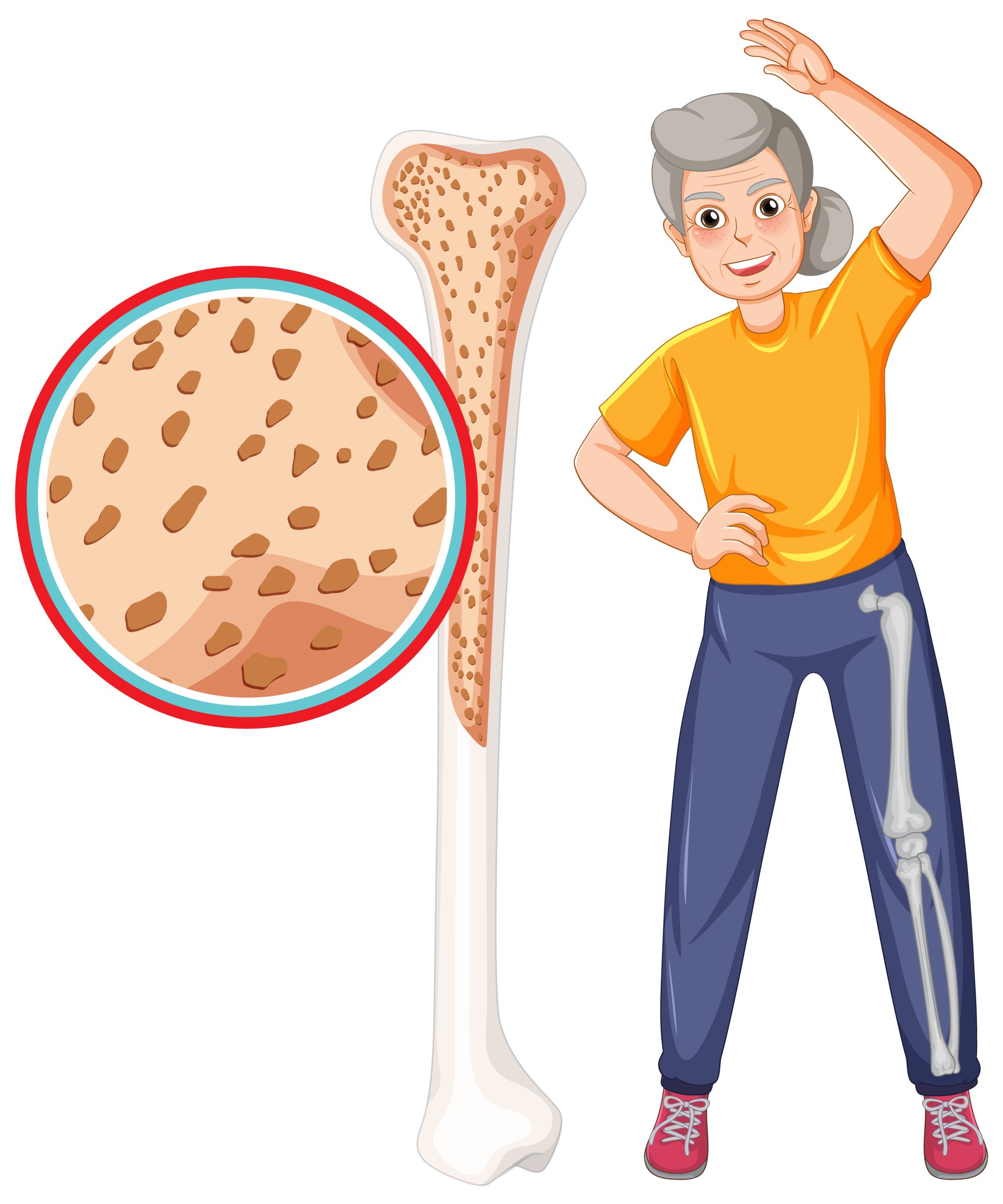 Osteoporosis in old people illustration